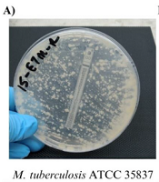 Jundishapur J Microbiol